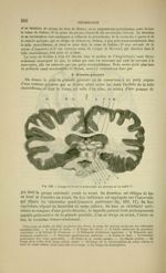 Fig. 192 - Coupe verticale transversale du cerveau et du bulbe - Nouveaux éléments d'anatomie descri [...]