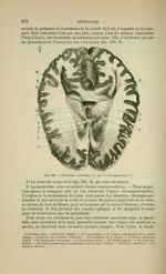 Fig. 196 - Troisième ventricule, vu par sa face supérieure - Nouveaux éléments d'anatomie descriptiv [...]