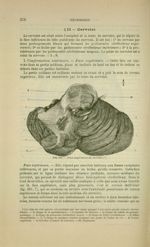 Fig. 200 - Face supérieure du cervelet - Nouveaux éléments d'anatomie descriptive et d'embryologie