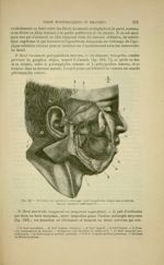 Fig. 216 - Divisions du maxillaire inférieur (nerf massétérin, temporaux profonds, buccal, dentaire  [...]