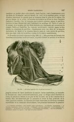 Fig. 230 - Branches superficielles du plexus cervical - Nouveaux éléments d'anatomie descriptive et  [...]