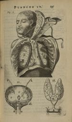 Planche IV - L'Anatomie du corps humain avec ses maladies, & les remedes pour les guerir. Nouvelle e [...]
