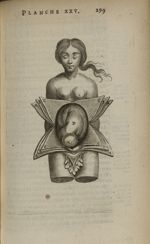 Planche XXV - L'Anatomie du corps humain avec ses maladies, & les remedes pour les guerir. Nouvelle  [...]