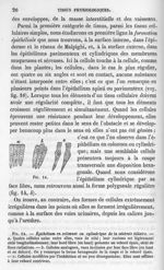 Fig. 14. Epithélium en colonnes ou cylindrique de la vésicule biliaire - La pathologie cellulaire ba [...]
