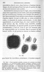 Fig. 120. Corps amyloïdes stratifiés provenant de la prostate - La pathologie cellulaire basée sur l [...]