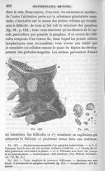 Fig. 122. Dégénerescence amyloïde d'un ganglion lymphatique / Fig. 123. Amylacés, corps de grosseurs [...]