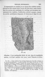 Fig. 133. Cartilage diaphysaire en voie de développement d'un tibia rachitique - La pathologie cellu [...]
