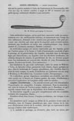 Fig. 60 : Baleine porte-éponge de Trousseau - Nouveau dictionnaire de médecine de chirurgie pratique [...]