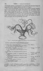 Fig. 80 : Grossesse dans un utérus bicorne - Nouveau dictionnaire de médecine de chirurgie pratiques [...]