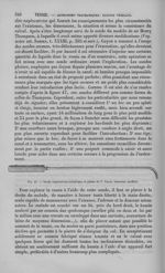 Fig. 47 : Sonde exploratrice métallique et pleine de F. Guyon - Nouveau dictionnaire de médecine de  [...]