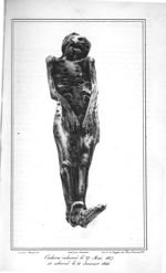 Cadavre inhumé le 27 mai 1827 et exhumé le 21 janvier 1828 - Traité de médecine légale, contenant le [...]