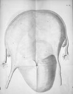Planche XII. L'utérus dans l'état de grossesse à terme, réduit aux deux tiers de son volume, représe [...]