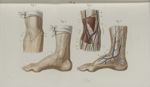 Pl. 4. 1° Saignée du bras. Fig. 1. - Anatomie. Fig. 2. - Procédé opératoire. 2°  Saignée du pied. Fi [...]
