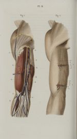 Pl. 8. Ligature de l'artère humérale - Précis iconographique de médecine opératoire et d'anatomie ch [...]