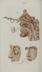 Pl. 38. Opérations qui se pratiquent sur l'appareil lacrymal - Précis iconographique de médecine opé [...]