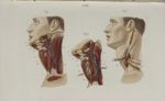Pl. 55. Oesophagotomie - Précis iconographique de médecine opératoire et d'anatomie chirurgicale / p [...]