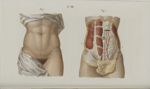 Pl. 58. Opérations qui se pratiquent sur l'abdomen - Précis iconographique de médecine opératoire et [...]