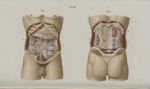 Pl. 68. Opération de l'anus artificiel. Anatomie - Précis iconographique de médecine opératoire et d [...]
