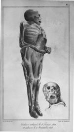 Planche 4. cadavre inhumé le 8 février 1828 et exhumé le 27 novembre 1828 - Traités des exhumations  [...]