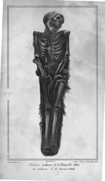Planche 5. cadavre inhumé le 22 décembre 1826 et exhumé le 22 janvier 1828 - Traités des exhumations [...]