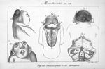 Planche VIII. Monstruosités. Fig. 1 et 2. Thlipsencéphale / Fig. 3 à 5. Anencéphale - Histoire génér [...]