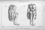 Planche IX. Monstruosités. Fig. 1 et 2. Momie d'Anencéphale - Histoire générale et particulière des  [...]