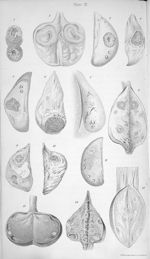 Fig. 1 à 6, 9 à 11. Corpus luteum / Fig. 7 et  8. The ovary of a woman who died sixteen days after m [...]