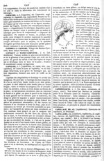 Fig. 60. [Capeline de la tête ou bonnet d'Hippocrate] - Dictionnaire de médecine, de chirurgie, de p [...]