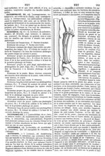 Fig. 163. [Appareil d'Hippocrate] - Dictionnaire de médecine, de chirurgie, de pharmacie, des scienc [...]