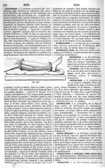 Fig. 168. [Appareil d'Hippocrate] - Dictionnaire de médecine, de chirurgie, de pharmacie, des scienc [...]