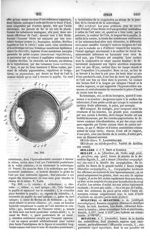 Fig. 308. Oeil - Dictionnaire de médecine, de chirurgie, de pharmacie, des sciences accessoires et d [...]