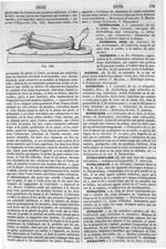 Fig. 185. [Appareil d'Hippocrate] - Dictionnaire de médecine, de chirurgie, de pharmacie, de l'art v [...]