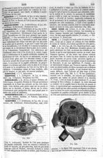 Fig. 245 et 246. [Iridotomie] - Dictionnaire de médecine, de chirurgie, de pharmacie, de l'art vétér [...]