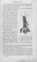 Fig. 11. Glande sébacée avec un poil follet - Leçons sur les maladies de la peau / vol. 1
