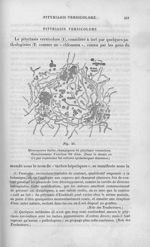 Fig. 50. Microsporon furfur, champignon du pityriasis versicolore - Leçons sur les maladies de la pe [...]