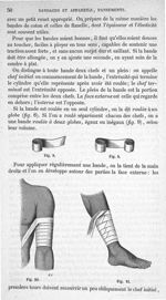 Fig. 8, 9, 10, 11 - Traité de médecine opératoire, bandages et appareils. 4è éd. Tome second