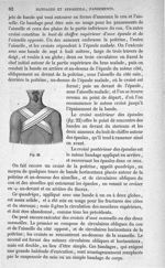 Fig. 22 - Traité de médecine opératoire, bandages et appareils. 4è éd. Tome second