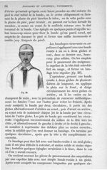 Fig. 26 - Traité de médecine opératoire, bandages et appareils. 4è éd. Tome second