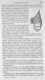 Fig. 27 - Traité de médecine opératoire, bandages et appareils. 4è éd. Tome second
