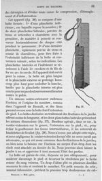 Fig. 37 - Traité de médecine opératoire, bandages et appareils. 4è éd. Tome second