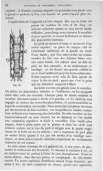 Fig. 38 - Traité de médecine opératoire, bandages et appareils. 4è éd. Tome second