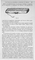Fig. 44 - Traité de médecine opératoire, bandages et appareils. 4è éd. Tome second