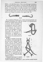 Fig. 50, 51, 52 - Traité de médecine opératoire, bandages et appareils. 4è éd. Tome second