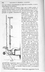 Fig. 53 - Traité de médecine opératoire, bandages et appareils. 4è éd. Tome second