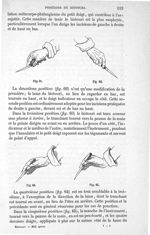 Fig. 61, 62, 63, 64 - Traité de médecine opératoire, bandages et appareils. 4è éd. Tome second