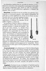 Fig. 67 - Traité de médecine opératoire, bandages et appareils. 4è éd. Tome second