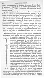 Fig. 70 - Traité de médecine opératoire, bandages et appareils. 4è éd. Tome second