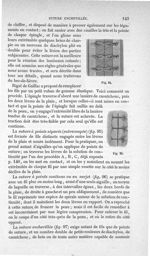 Fig. 94, 95 - Traité de médecine opératoire, bandages et appareils. 4è éd. Tome second