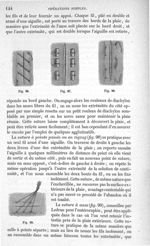 Fig. 96 à Fig. 99 - Traité de médecine opératoire, bandages et appareils. 4è éd. Tome second
