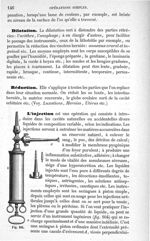 Fig. 104 - Traité de médecine opératoire, bandages et appareils. 4è éd. Tome second